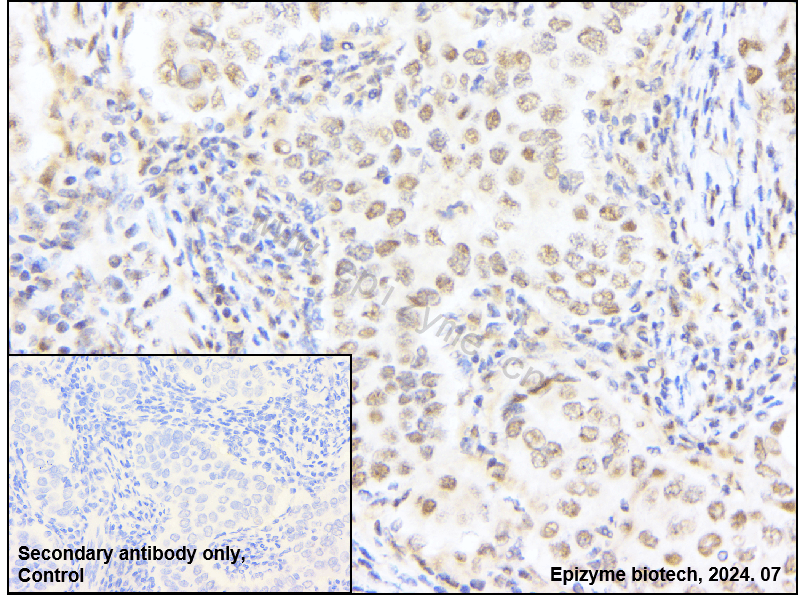 Anti-Mre11 Rabbit mAb [57Q19C54]