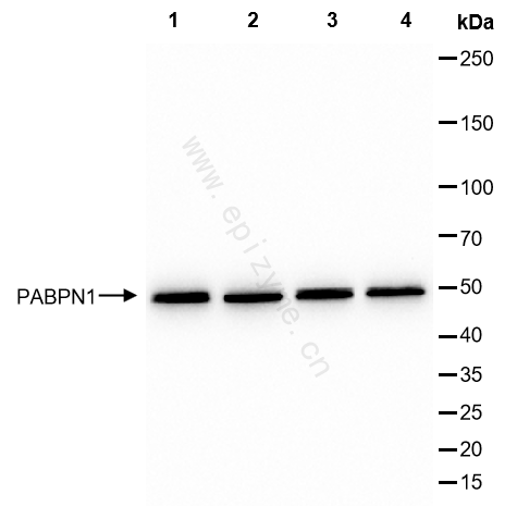 Anti-PABPN1 Rabbit mAb [51I79R48]