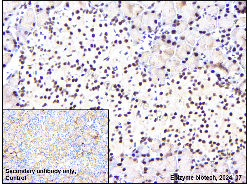 Anti-PABPN1 Rabbit mAb [51I79R48]