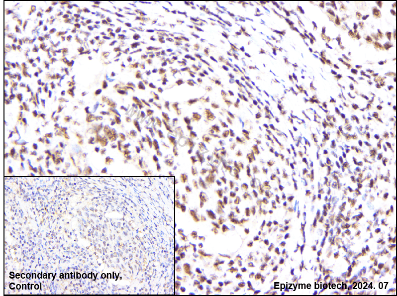 Anti-PABPN1 Rabbit mAb [51I79R48]