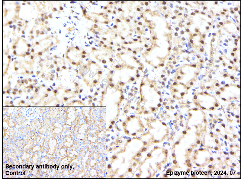 Anti-PABPN1 Rabbit mAb [51I79R48]