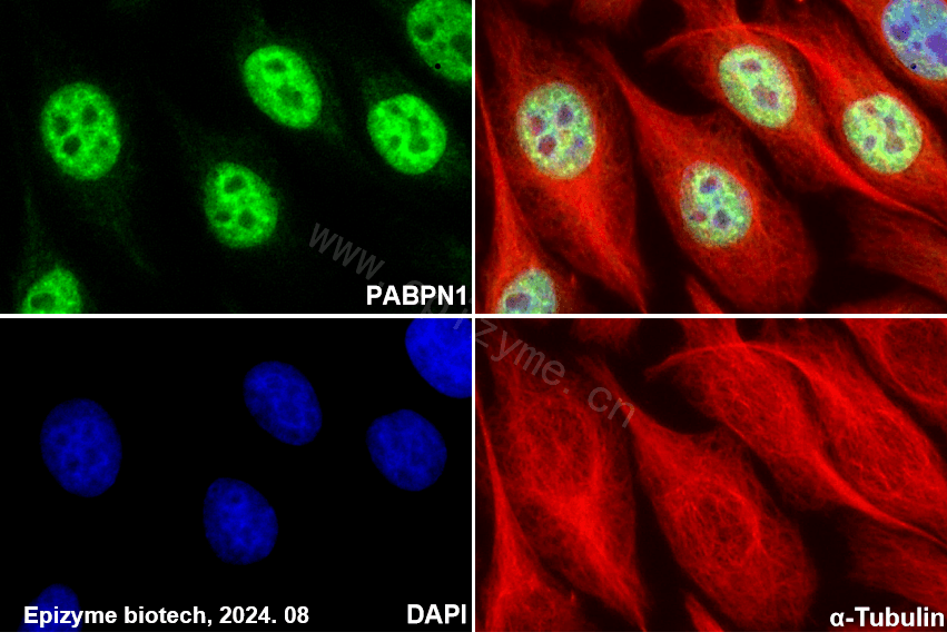 Anti-PABPN1 Rabbit mAb [51I79R48]