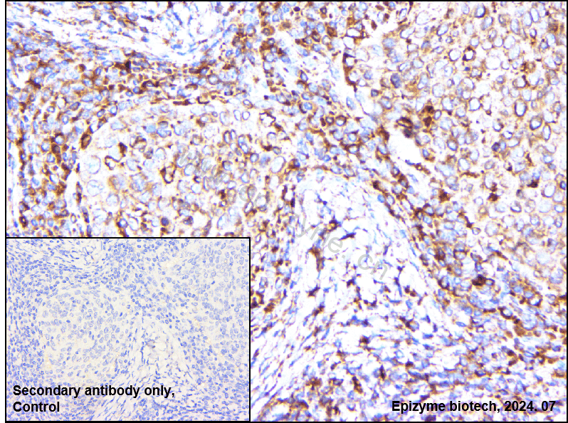 Anti-ERp57 Rabbit mAb [52S98N13]