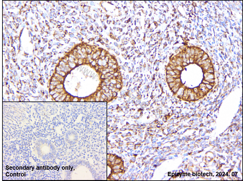 Anti-ERp57 Rabbit mAb [52S98N13]