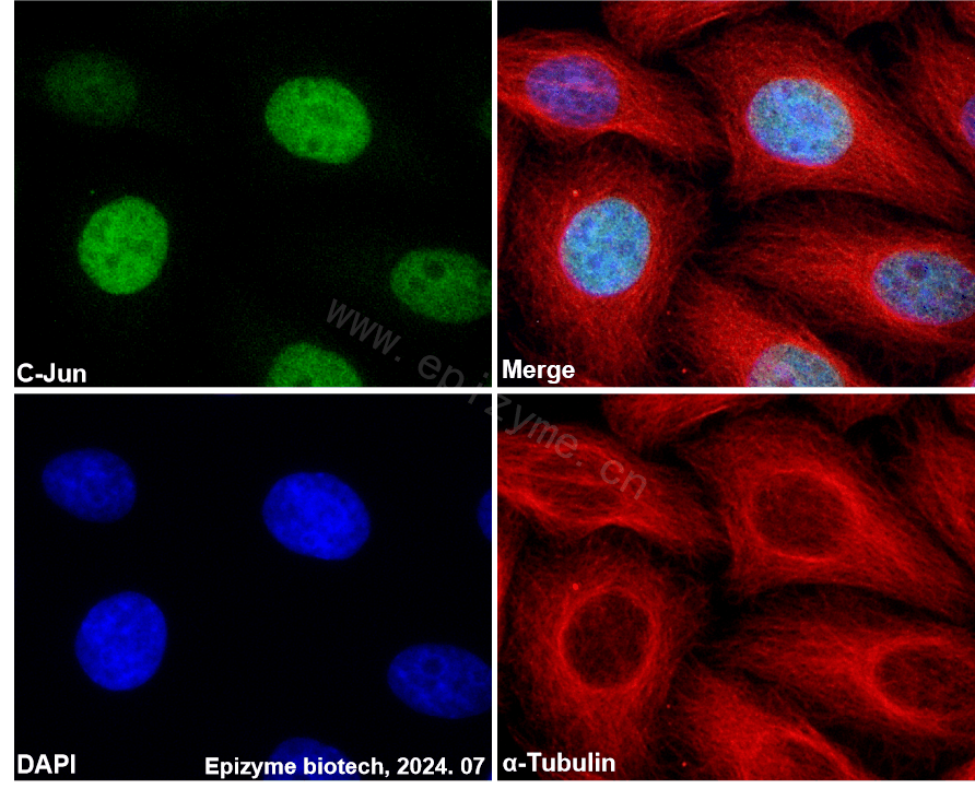 Anti-c-Jun Rabbit mAb [84B67L57]