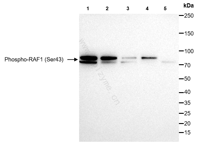 Anti-Phospho-RAF1 (Ser43) Rabbit mAb [37K08D45]