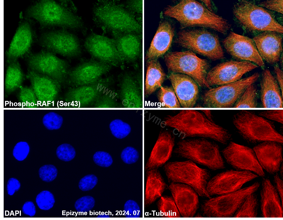 Anti-Phospho-RAF1 (Ser43) Rabbit mAb [37K08D45]