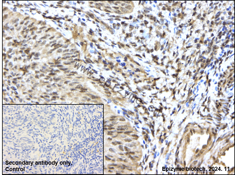 Anti-Phospho-RAF1 (Ser43) Rabbit mAb [37K08D45]