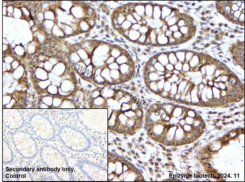 Anti-Phospho-RAF1 (Ser43) Rabbit mAb [37K08D45]
