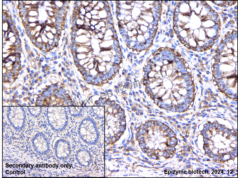 Anti-RAB13 Rabbit mAb [44L38A36]