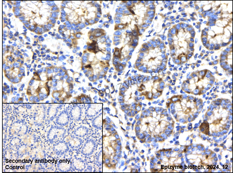 Anti-RAB13 Rabbit mAb [44L38A36]