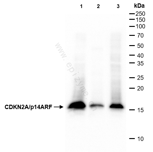 Anti-CDKN2A Rabbit mAb [25G78T67]