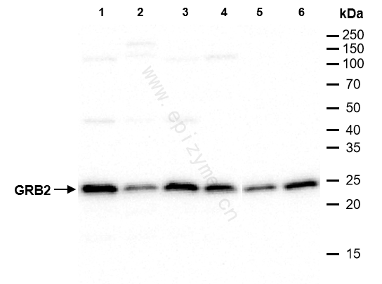 Anti-GRB2 Rabbit mAb [50H22Q25]