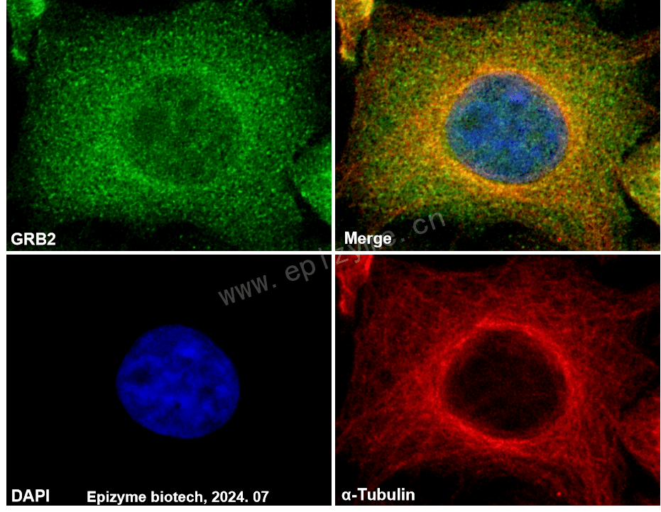 Anti-GRB2 Rabbit mAb [50H22Q25]