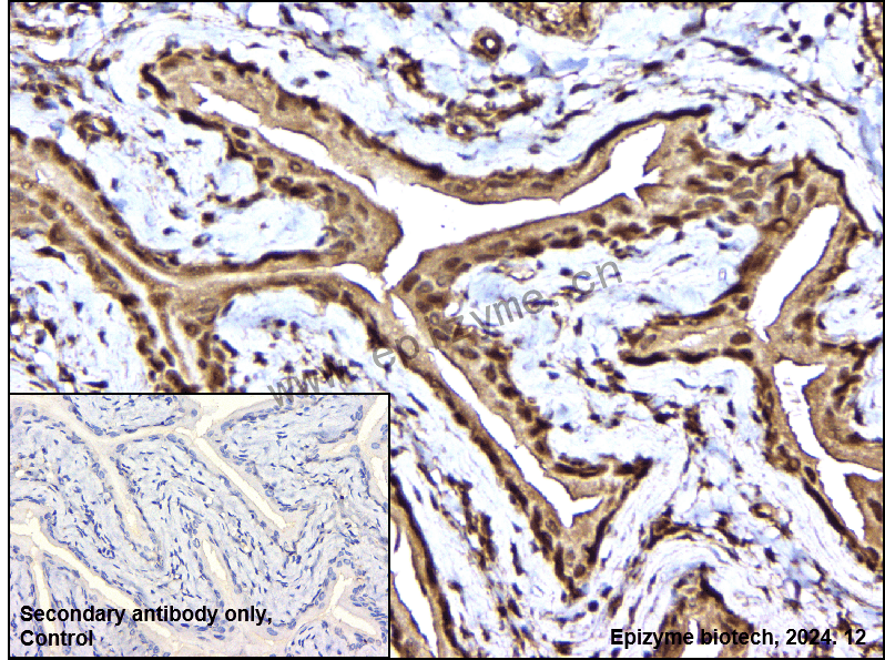Anti-GRB2 Rabbit mAb [50H22Q25]