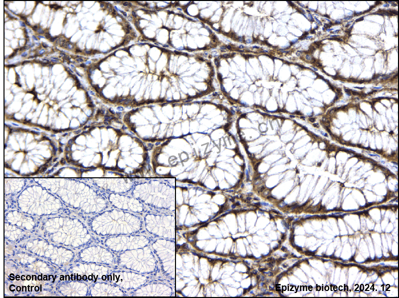Anti-GRB2 Rabbit mAb [50H22Q25]