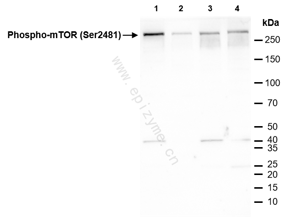 Anti-Phospho-mTOR (Ser2481) Rabbit mAb [89P95T30]