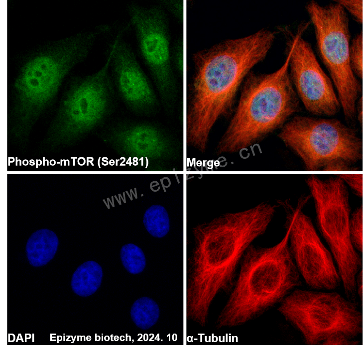 Anti-Phospho-mTOR (Ser2481) Rabbit mAb [89P95T30]