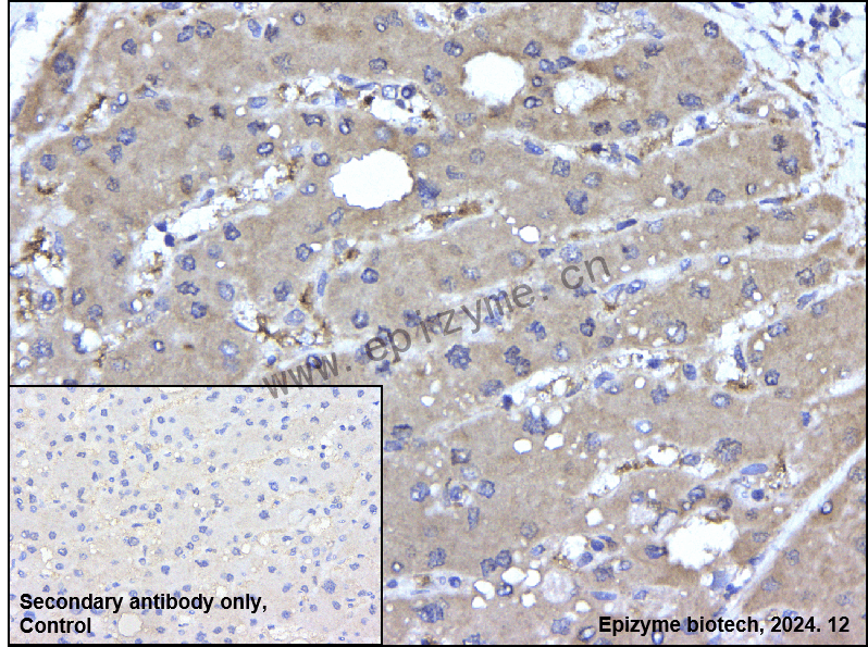 Anti-Phospho-mTOR (Ser2481) Rabbit mAb [89P95T30]