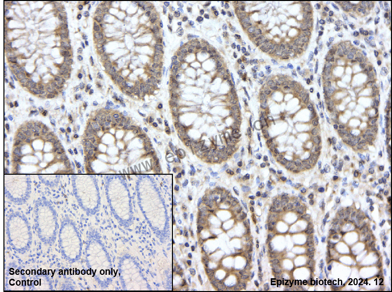 Anti-Phospho-mTOR (Ser2481) Rabbit mAb [89P95T30]