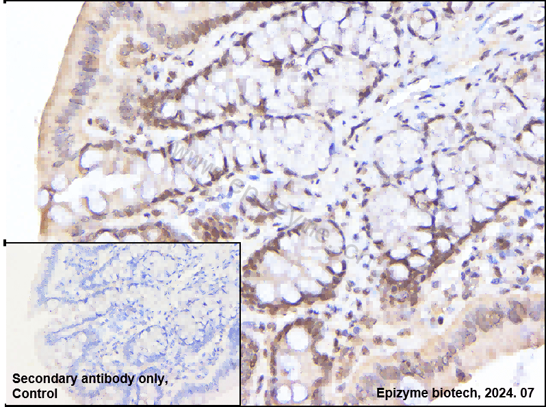 Anti-TLS/FUS Rabbit mAb [62K70I40]