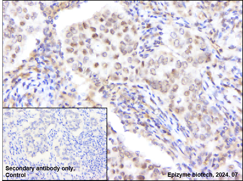 Anti-TLS/FUS Rabbit mAb [62K70I40]