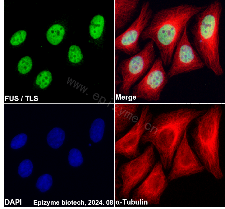 Anti-TLS/FUS Rabbit mAb [62K70I40]