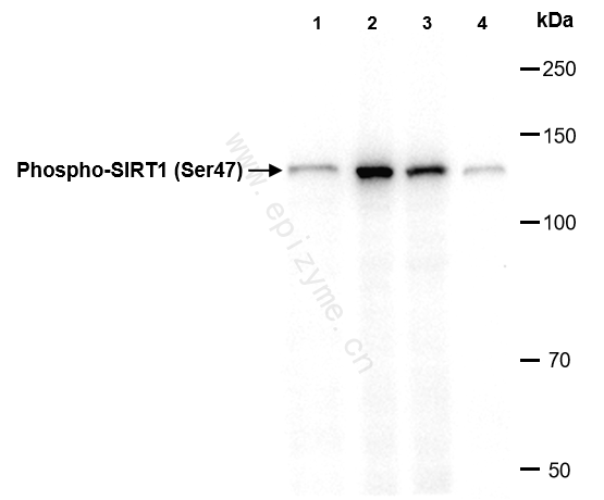 Anti-Phospho-SIRT1 (Ser47) Rabbit mAb [49C75S90]