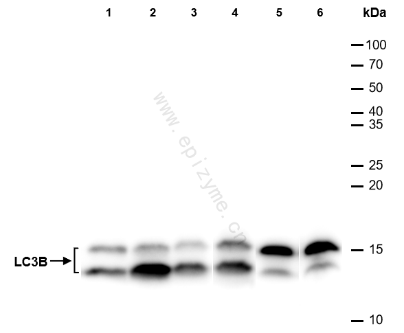 Anti-LC3B Rabbit mAb [95F45F38]