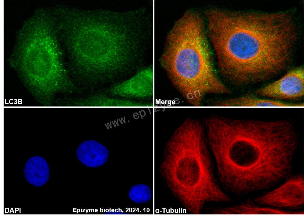 Anti-LC3B Rabbit mAb [95F45F38]