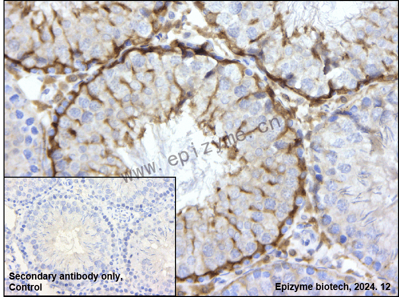 Anti-LC3B Rabbit mAb [95F45F38]
