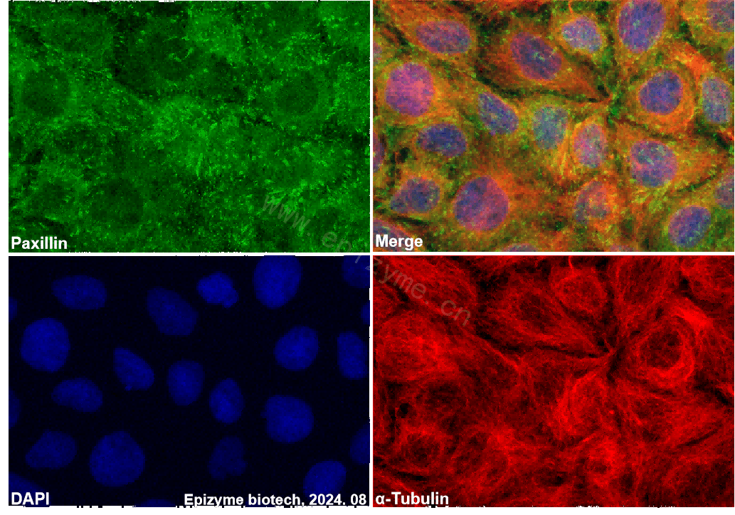 Anti-Paxillin Rabbit mAb [91A68I01]