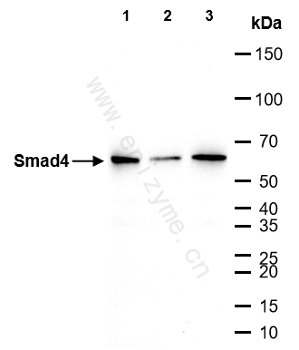 Anti-Smad4 Rabbit mAb [70G40K17]