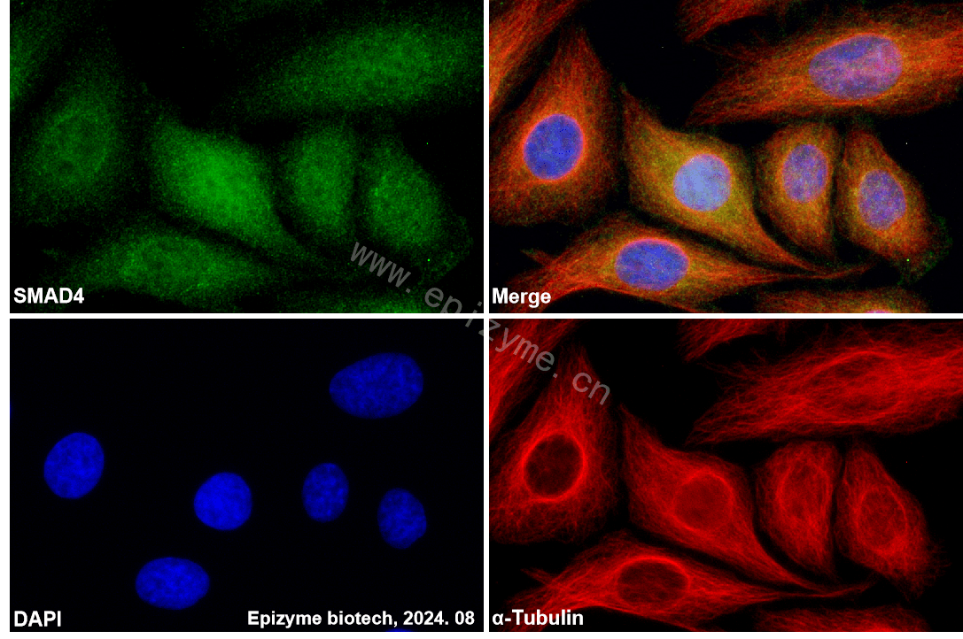 Anti-Smad4 Rabbit mAb [70G40K17]