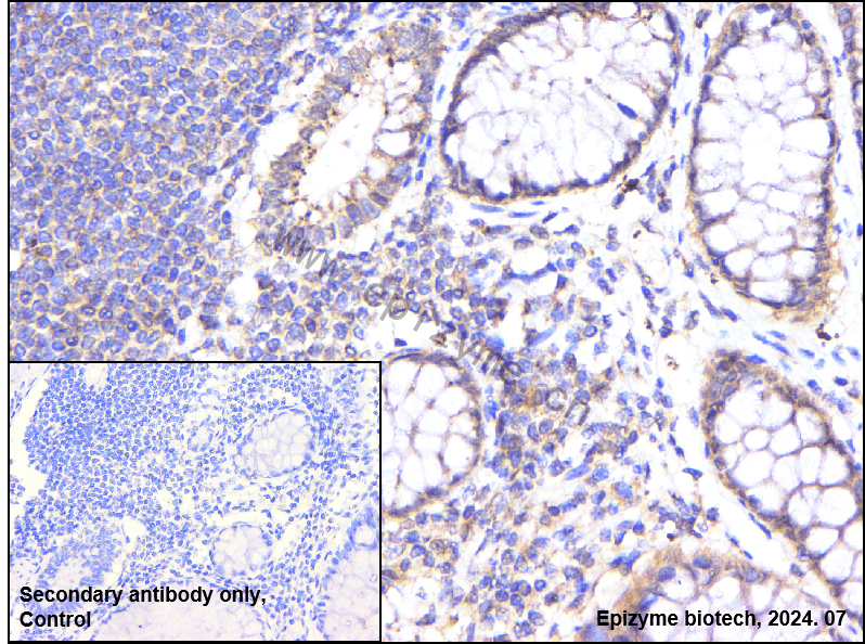 Anti-Smad4 Rabbit mAb [70G40K17]