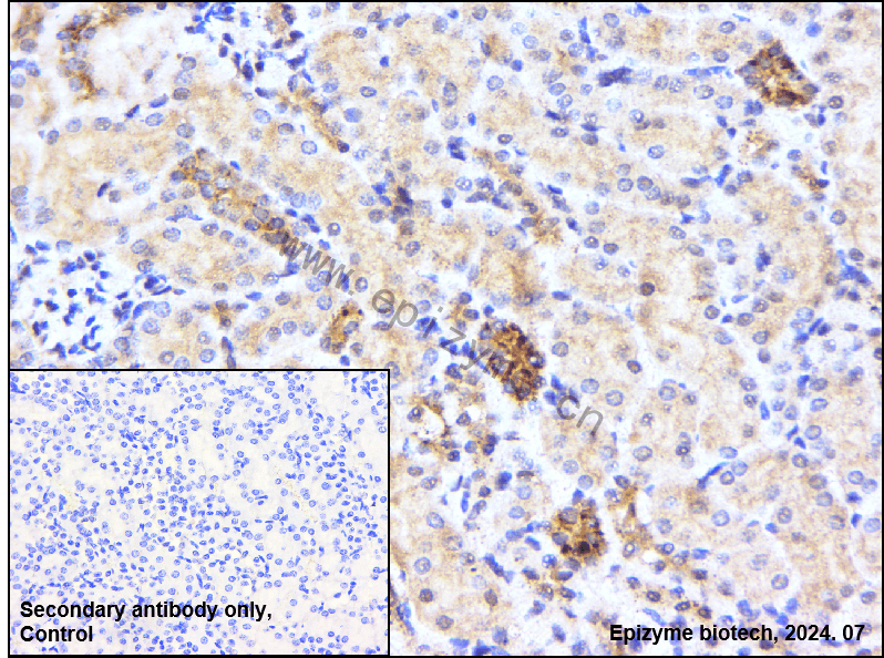 Anti-Smad4 Rabbit mAb [70G40K17]