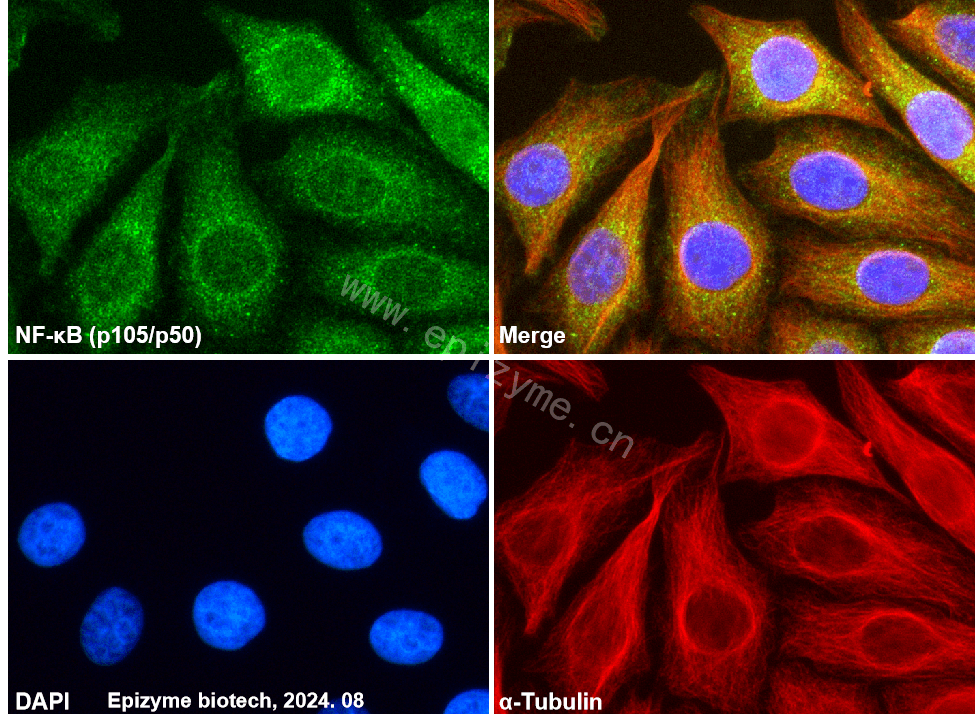 Anti-NF-KB p105/p50 Rabbit mAb [72Q88S90]