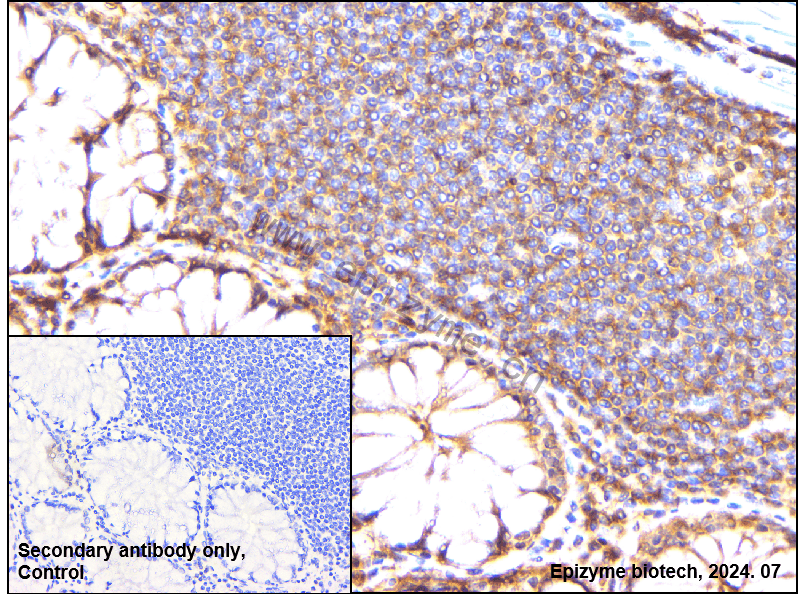 Anti-NF-KB p105/p50 Rabbit mAb [72Q88S90]