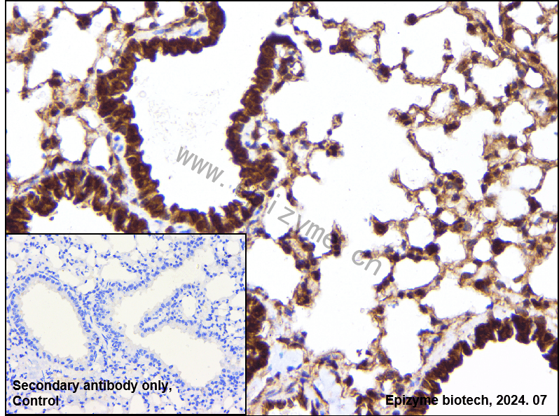 Anti-NF-KB p105/p50 Rabbit mAb [72Q88S90]