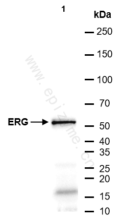 Anti-ERG Rabbit mAb [19E22Q08]
