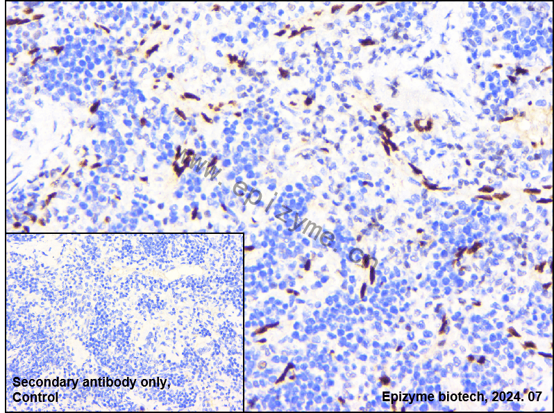 Anti-ERG Rabbit mAb [19E22Q08]
