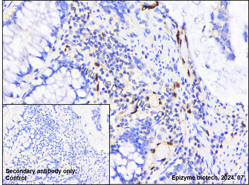 Anti-ERG Rabbit mAb [19E22Q08]