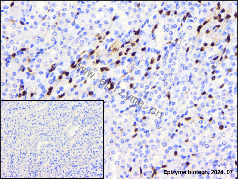 Anti-ERG Rabbit mAb [19E22Q08]