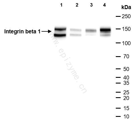 Anti-Integrin beta 1 Rabbit mAb [46C78P70]