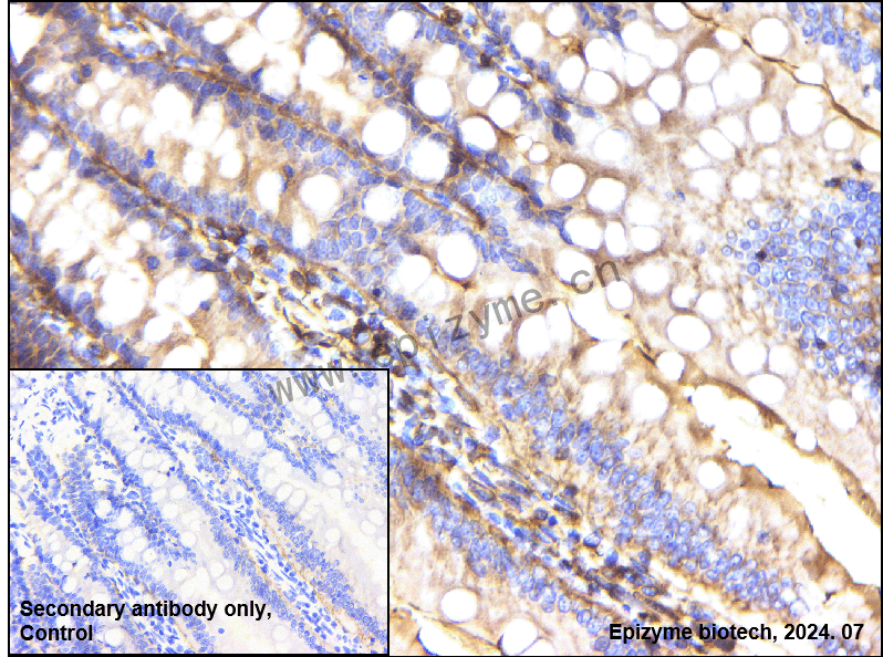 Anti-Integrin beta 1 Rabbit mAb [46C78P70]
