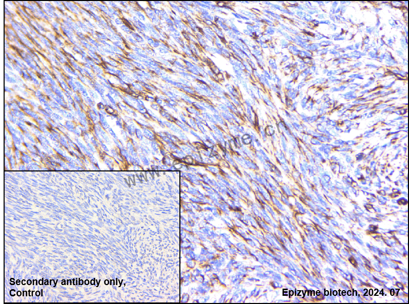 Anti-Integrin beta 1 Rabbit mAb [46C78P70]