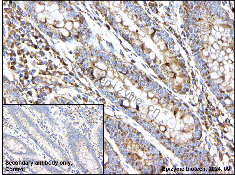 Anti-Torsin A Rabbit mAb [50B53A66]