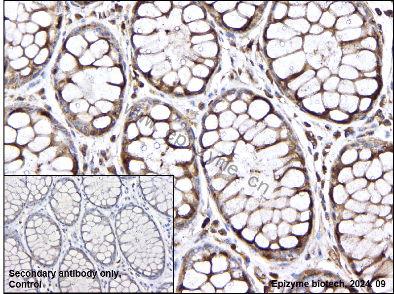 Anti-Torsin A Rabbit mAb [50B53A66]