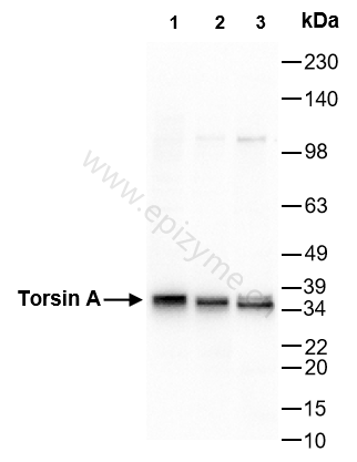 Anti-Torsin A Rabbit mAb [50B53A66]