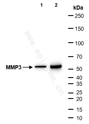 Anti-MMP3 Rabbit mAb [32A98J22]